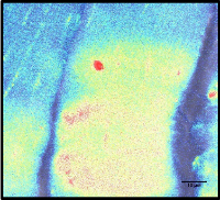 muscle fiber