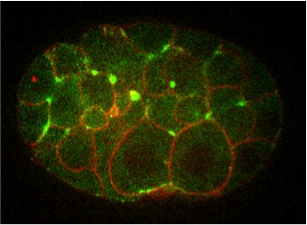 Membrane